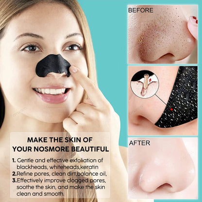 Unisex Blackhead Removal Mask