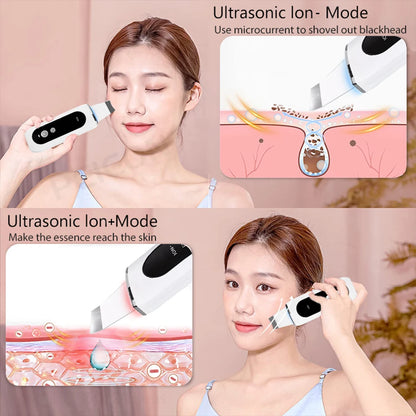 Ultrasonic Skin Scrubber Peeling Blackhead Remover